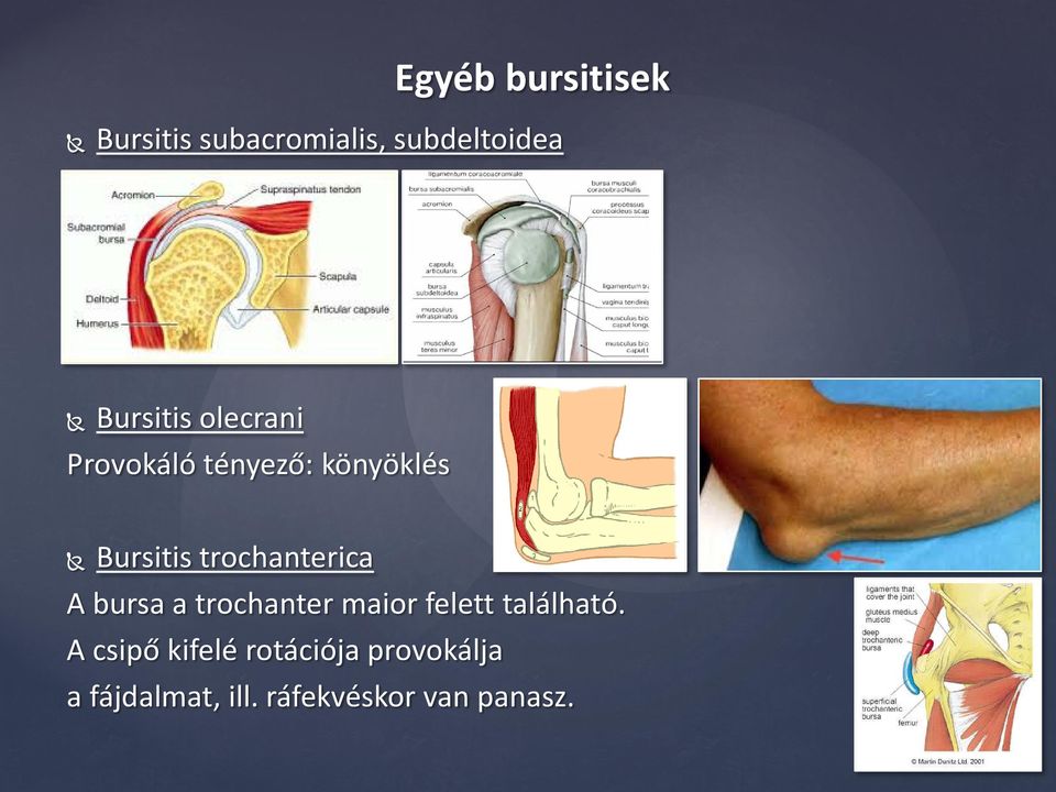 trochanterica A bursa a trochanter maior felett található.