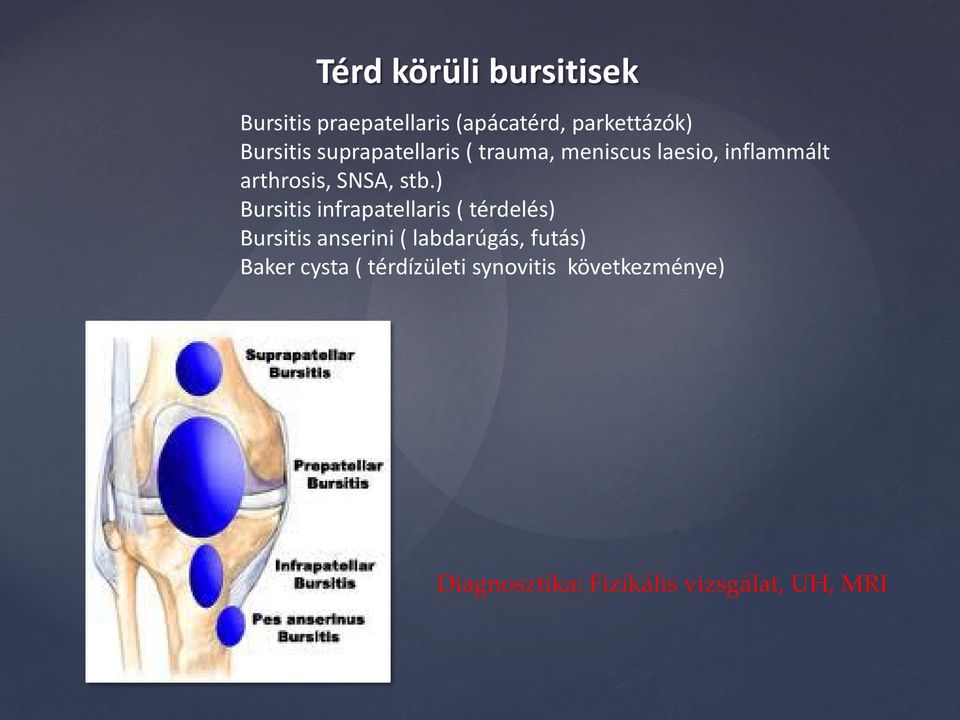 ) Bursitis infrapatellaris ( térdelés) Bursitis anserini ( labdarúgás, futás)