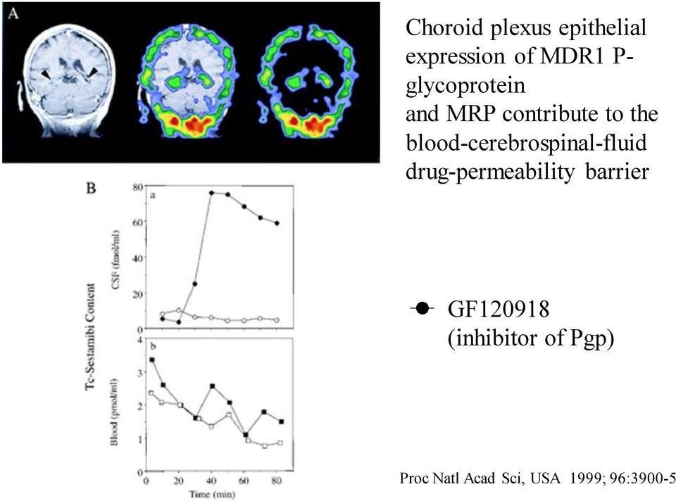 blood-cerebrospinal-fluid drug-permeability barrier