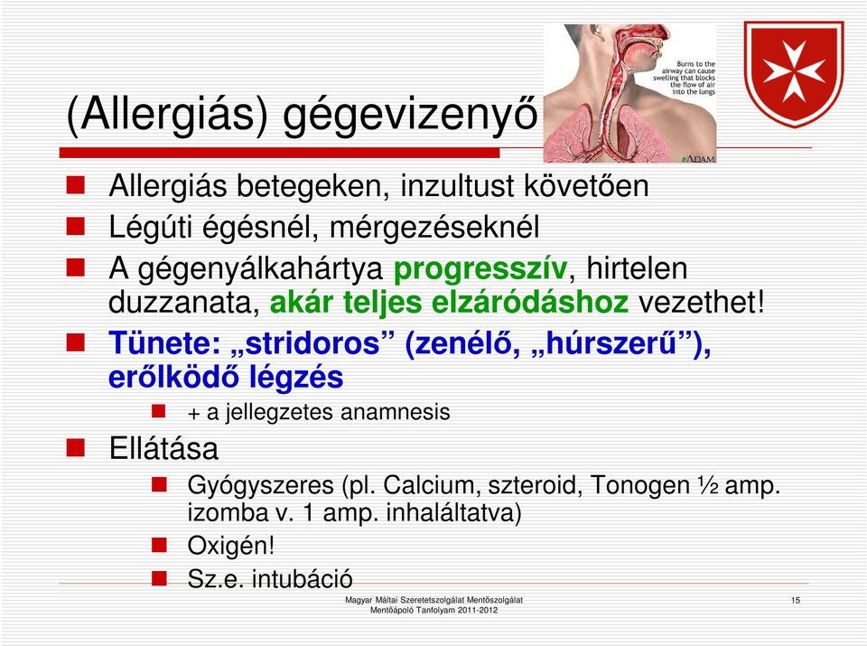 Tünete: stridoros (zenélő, húrszerű ), erőlködő légzés + a jellegzetes anamnesis Ellátása