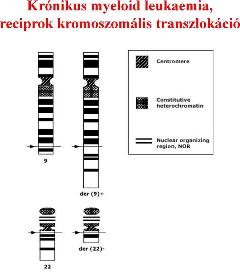 leukaemia,