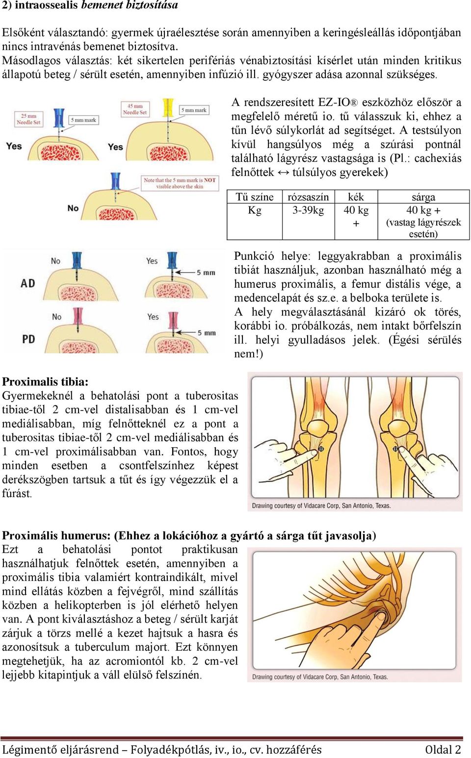 Proximalis tibia: Gyermekeknél a behatolási pont a tuberositas tibiae-től 2 cm-vel distalisabban és 1 cm-vel mediálisabban, míg felnőtteknél ez a pont a tuberositas tibiae-től 2 cm-vel mediálisabban