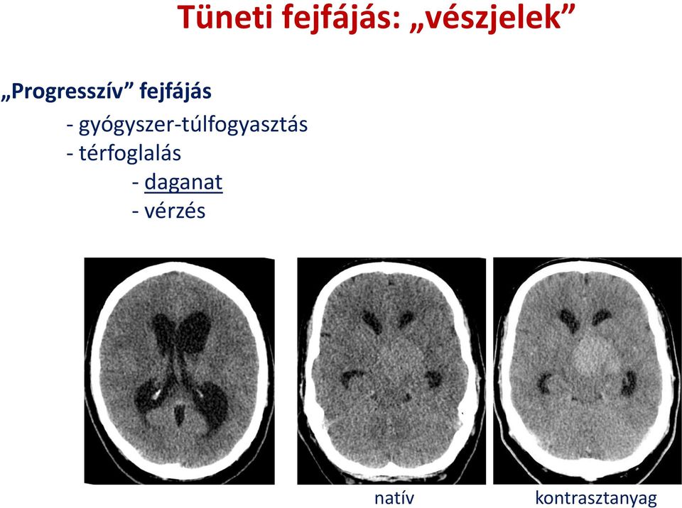 gyógyszer-túlfogyasztás -