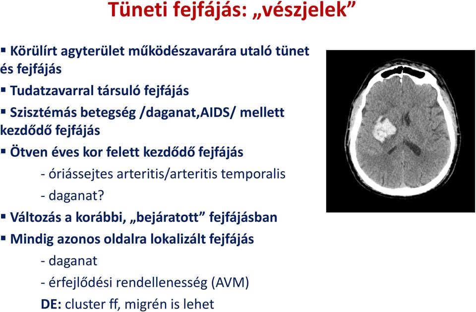 fejfájás - óriássejtes arteritis/arteritis temporalis -daganat?