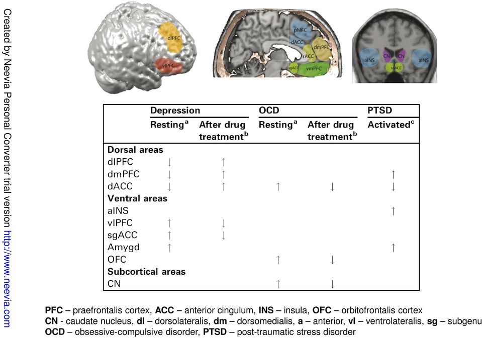 dm dorsomedialis, a anterior, vl ventrolateralis, sg subgenu OCD