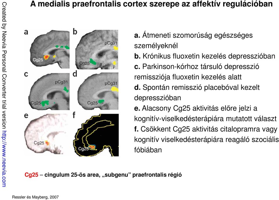 Parkinson-kórhoz társuló depresszió remissziója fluoxetin kezelés alatt d. Spontán remisszió placebóval kezelt depresszióban e.