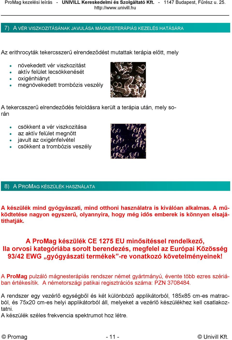 csökkent a trombózis veszély 8) A PROMAG KÉSZÜLÉK HASZNÁLATA A készülék mind gyógyászati, mind otthoni használatra is kiválóan alkalmas.