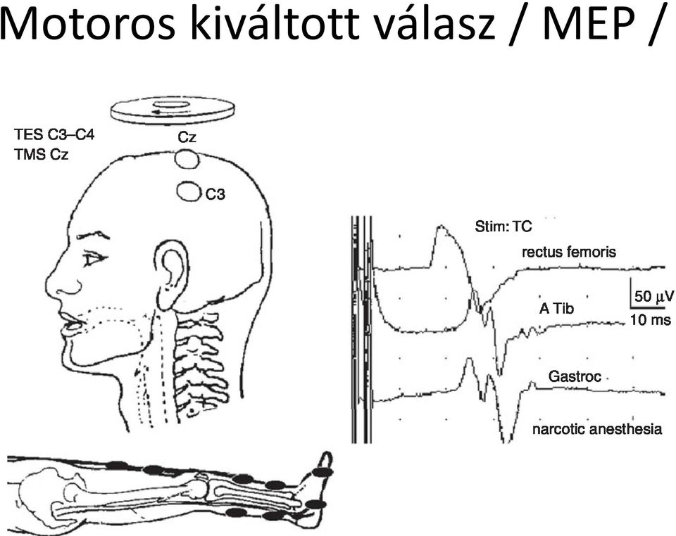 válasz /