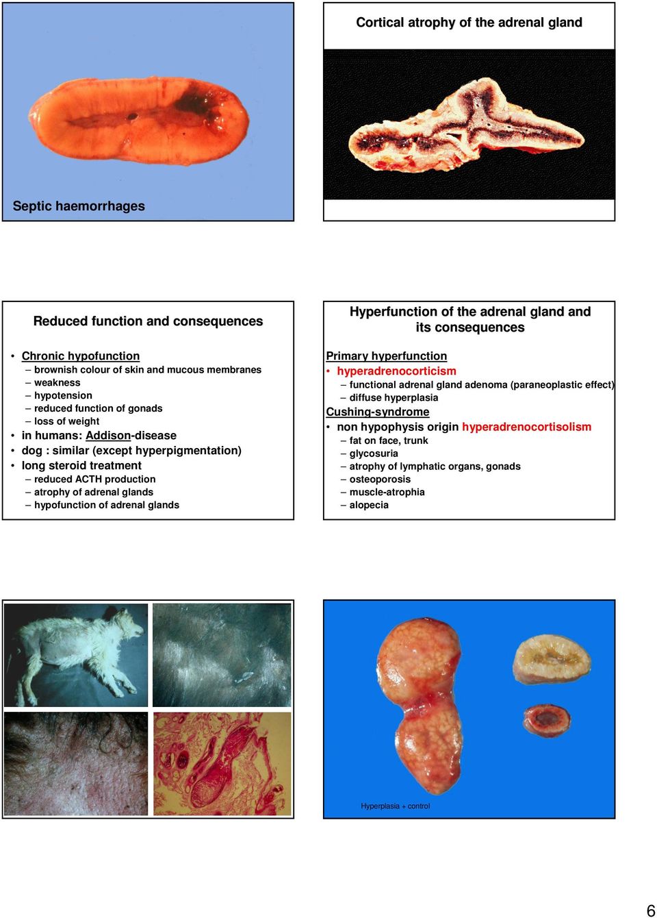 of adrenal glands Hyperfunction of the adrenal gland and its consequences Primary hyperfunction hyperadrenocorticism functional adrenal gland adenoma (paraneoplastic effect) diffuse