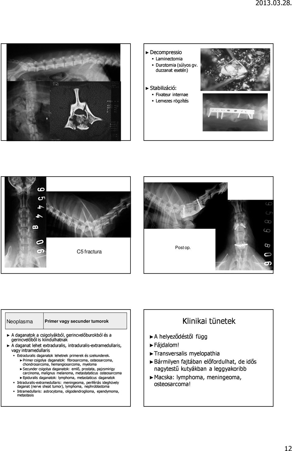 extramedullaris is, vagy intramedullaris is Extraduralis daganatok lehetnek primerek és szekunderek.