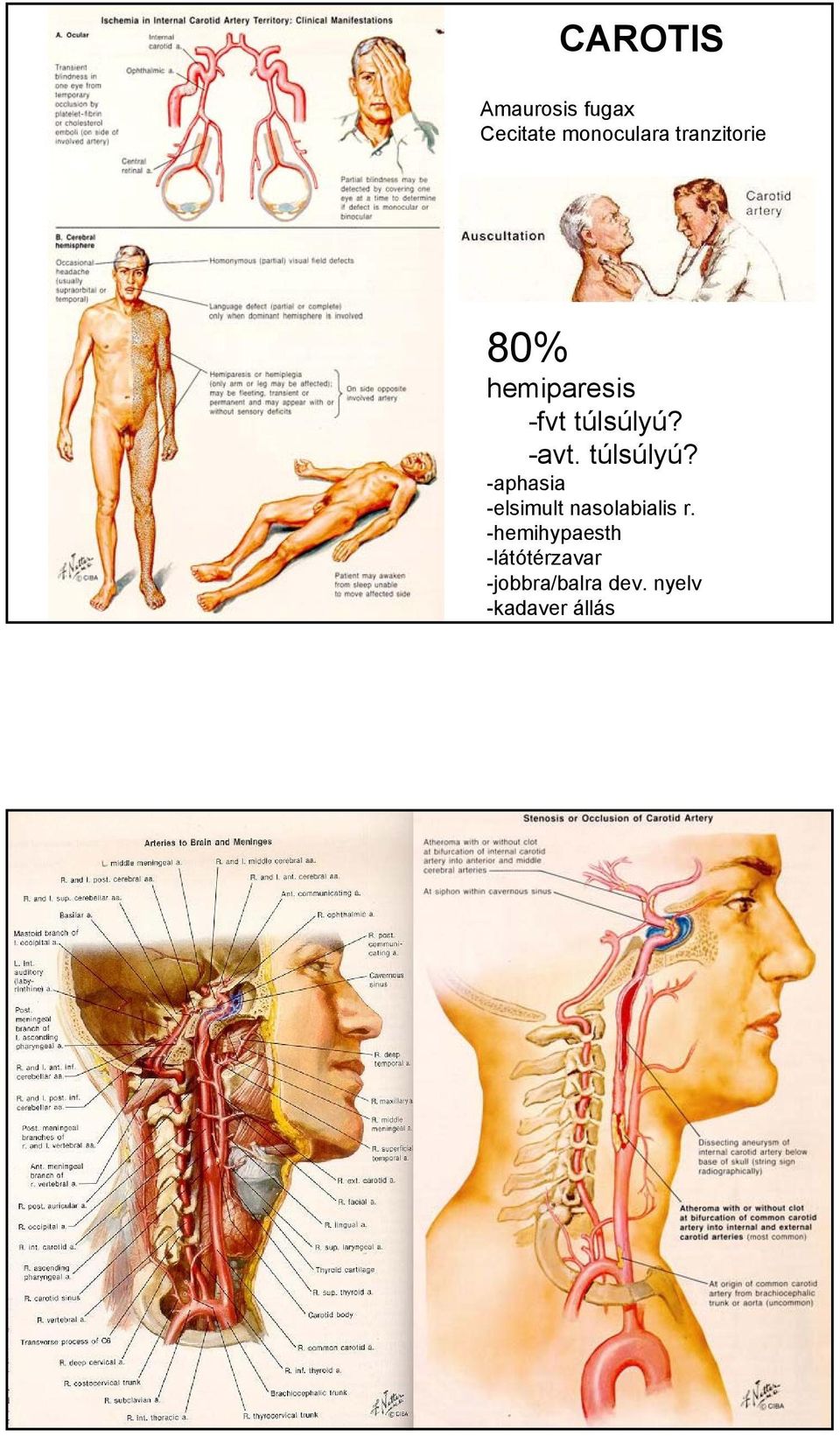 túlsúlyú? -aphasia -elsimult nasolabialis r.