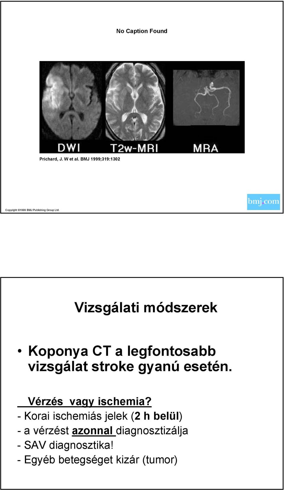 Vizsgálati módszerek Koponya CT a legfontosabb vizsgálat stroke gyanú esetén.