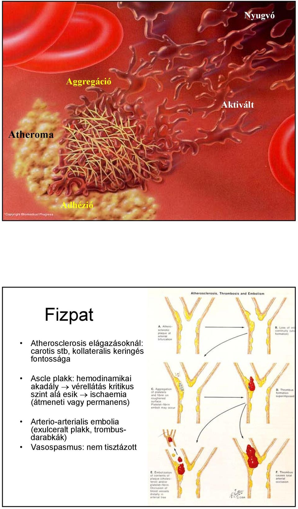 hemodinamikai akadály vérellátás kritikus szint alá esik ischaemia (átmeneti