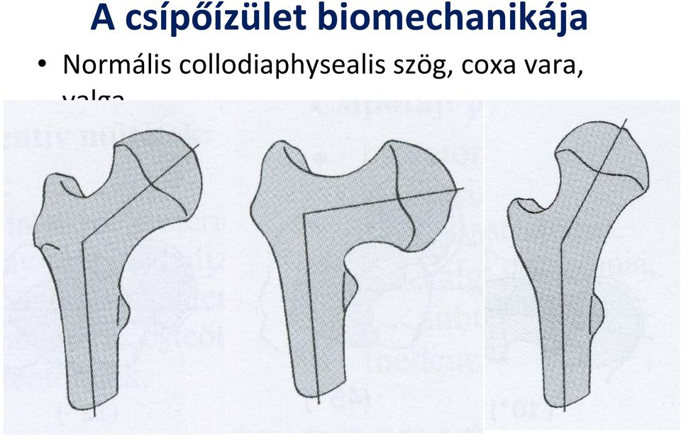 Normális