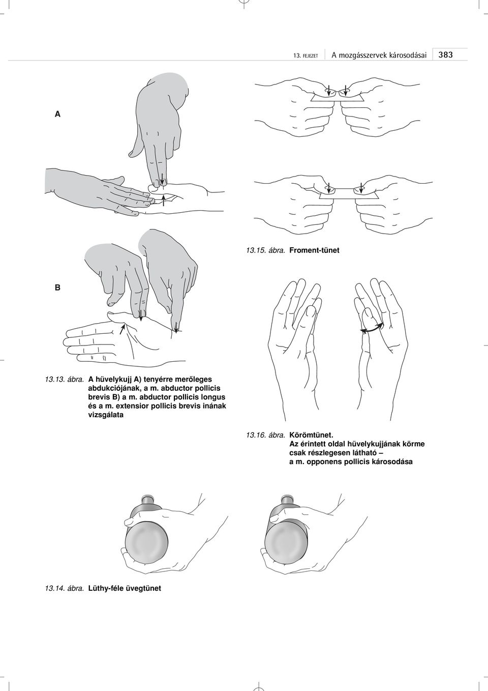 extensior pollicis brevis inának vizsgálata 13.16. ábra. Körömtünet.