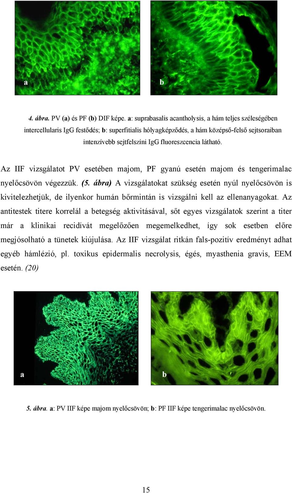 látható. Az IIF vizsgálatot PV esetében majom, PF gyanú esetén majom és tengerimalac nyelőcsövön végezzük. (5.