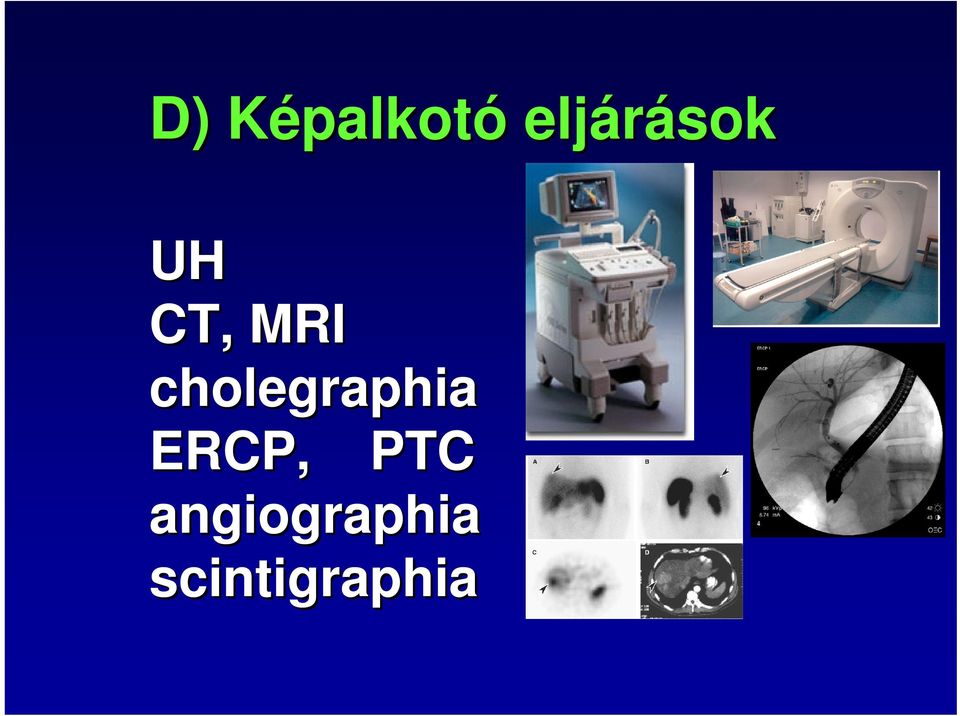cholegraphia ERCP, PTC