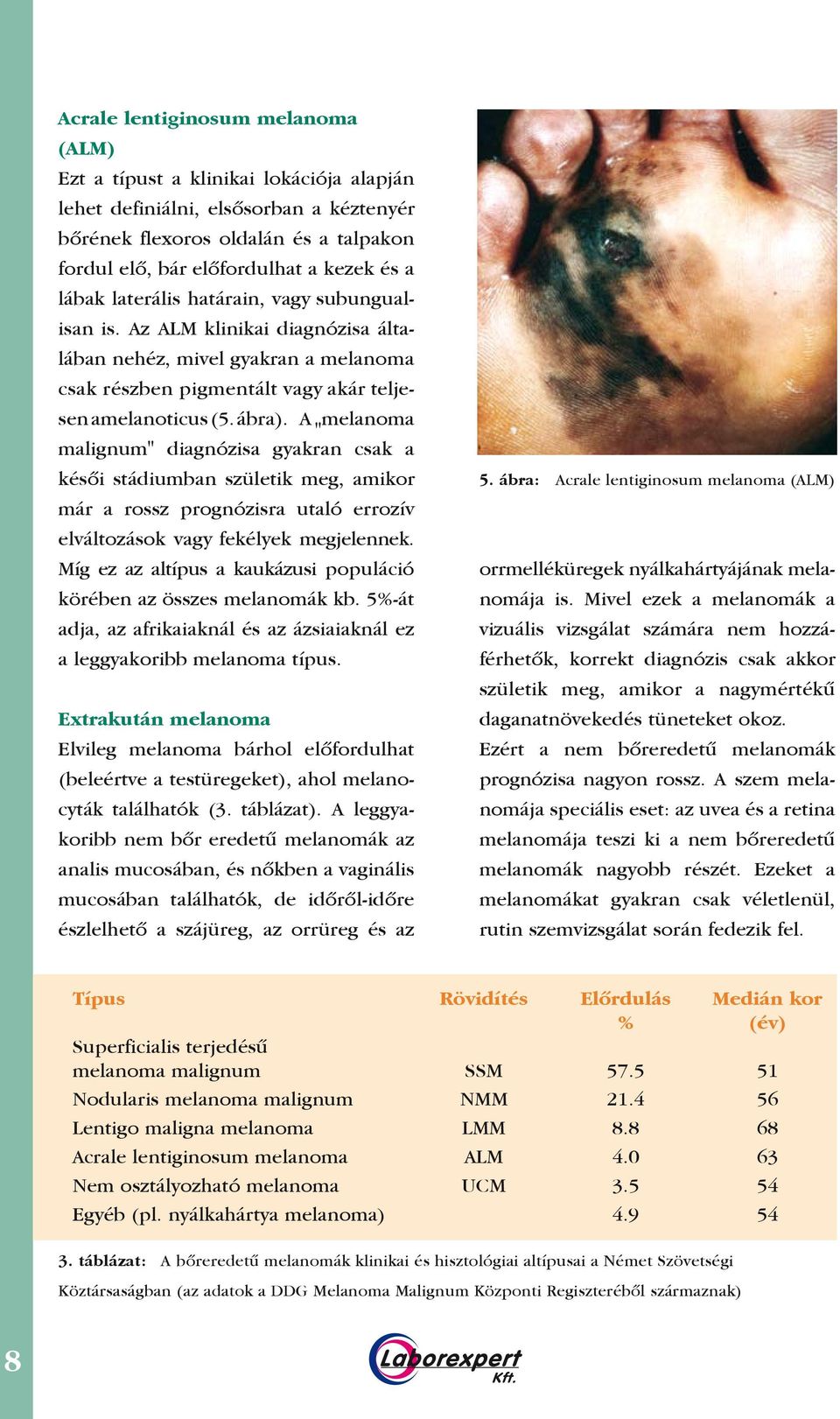 A melanoma " malignum" diagnózisa gyakran csak a késôi stádiumban születik meg, amikor már a rossz prognózisra utaló errozív elváltozások vagy fekélyek megjelennek.