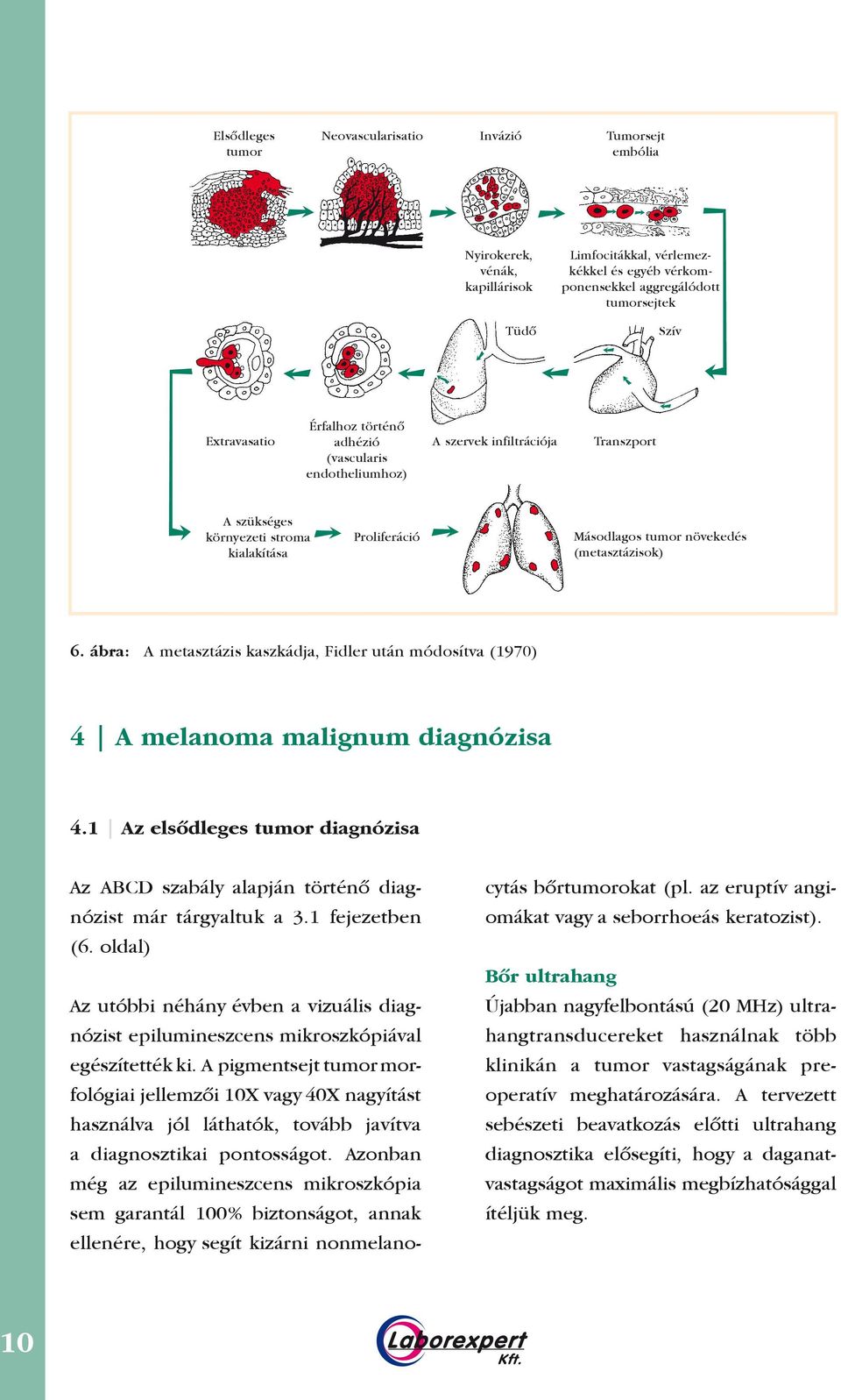 ábra: A metasztázis kaszkádja, Fidler után módosítva (1970) 4 A melanoma malignum diagnózisa 4.1 Az elsôdleges tumor diagnózisa Az ABCD szabály alapján történô diagnózist már tárgyaltuk a 3.
