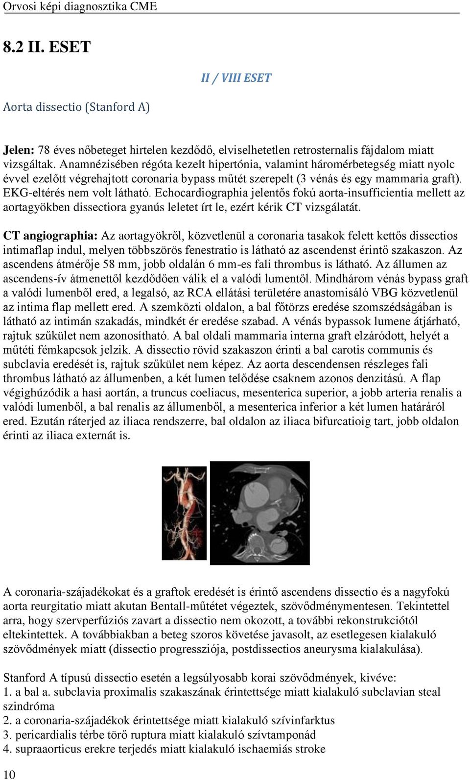 Echocardiographia jelentős fokú aorta-insufficientia mellett az aortagyökben dissectiora gyanús leletet írt le, ezért kérik CT vizsgálatát.