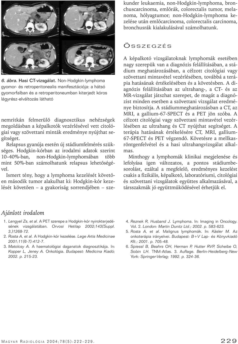 Non-Hodgkin-lymphoma gyomor- és retroperitonealis manifesztációja: a hátsó gyomorfalban és a retroperitoneumban kiterjedt kóros lágyrész-elváltozás látható nemritkán felmerülô diagnosztikus