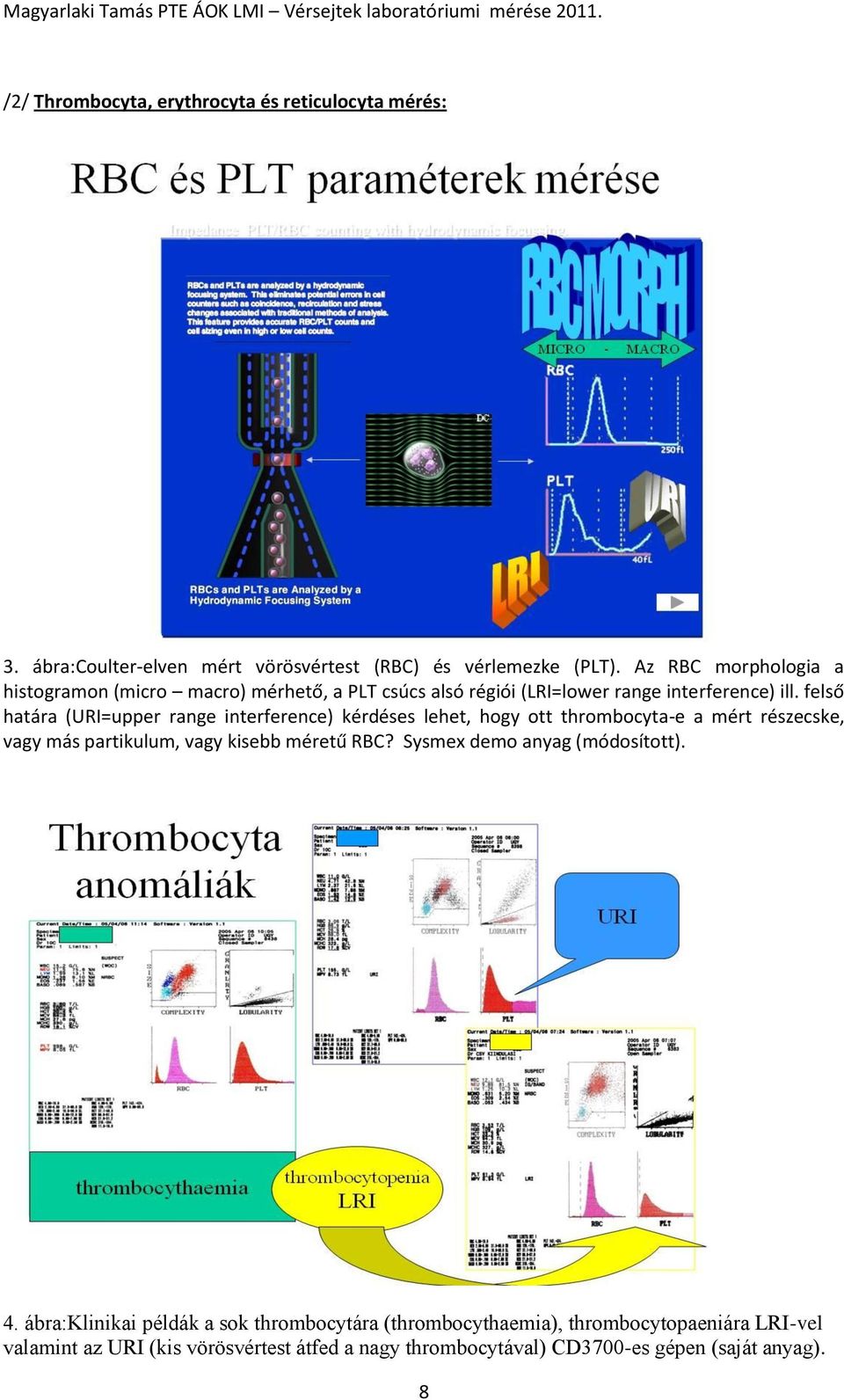 felső határa (URI=upper range interference) kérdéses lehet, hogy ott thrombocyta-e a mért részecske, vagy más partikulum, vagy kisebb méretű RBC?