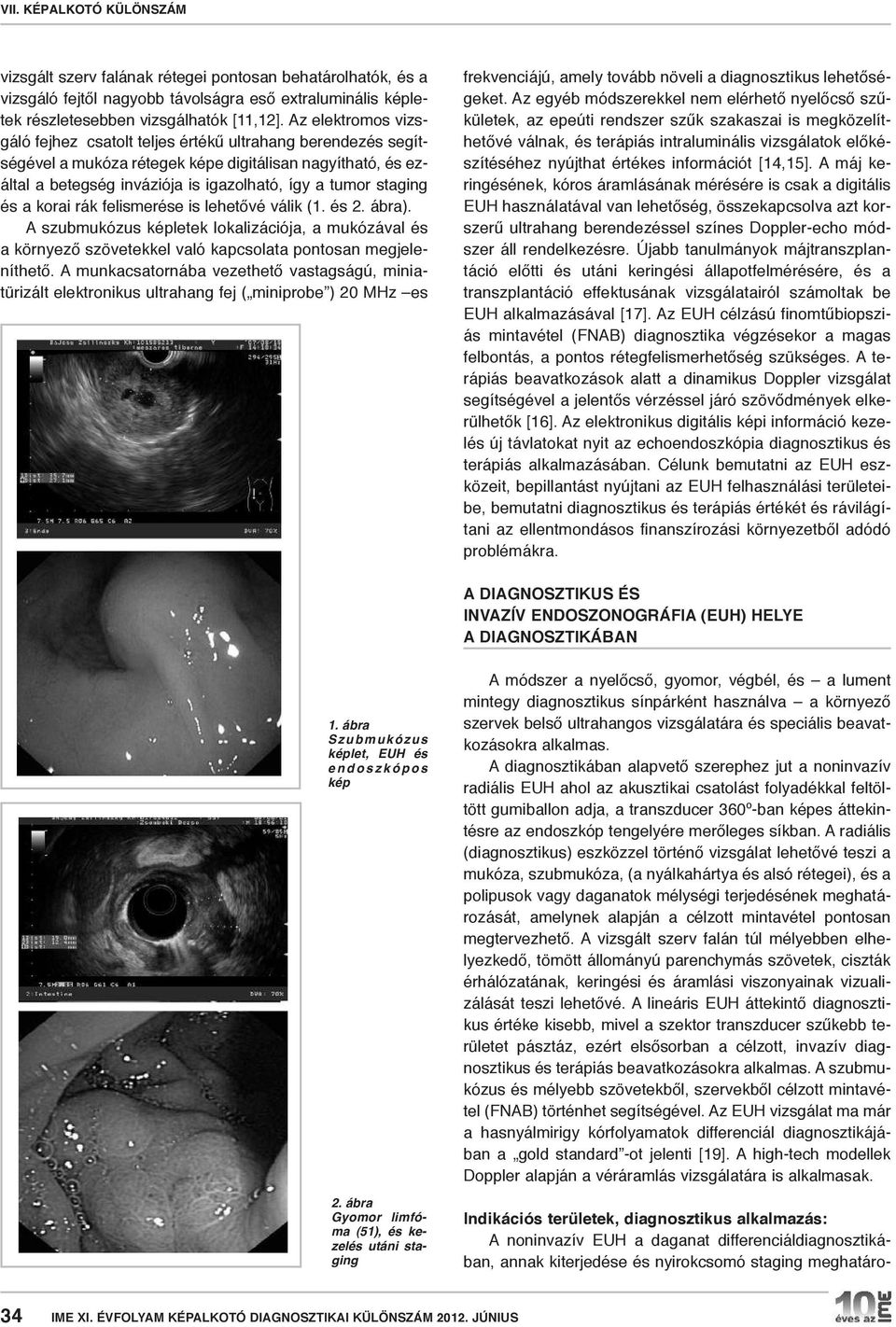 és a korai rák felismerése is lehetővé válik (1. és 2. ábra). A szubmukózus képletek lokalizációja, a mukózával és a környező szövetekkel való kapcsolata pontosan megjeleníthető.