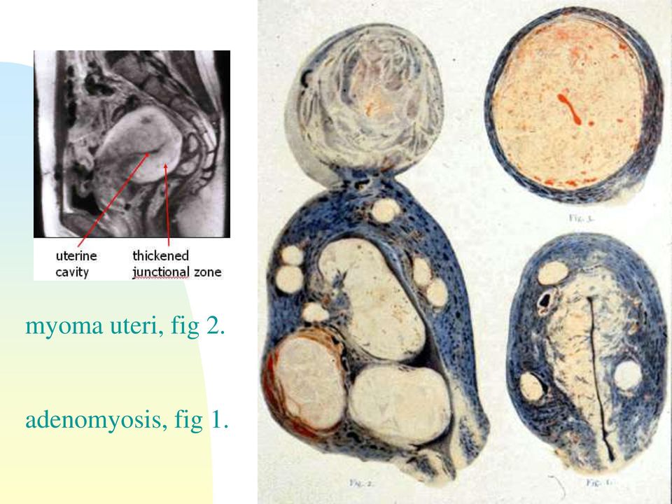 fig 2.