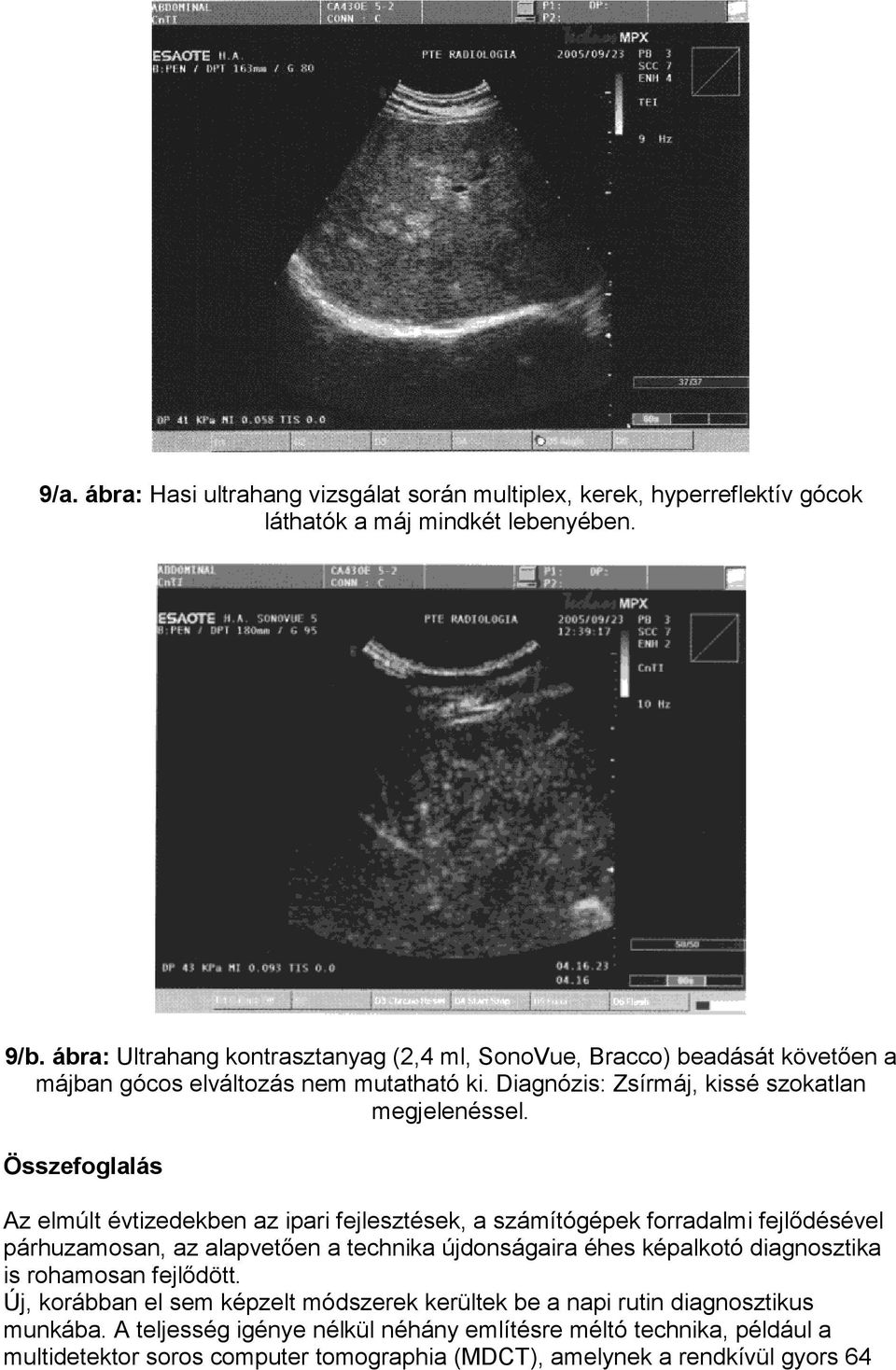 Összefoglalás Az elmúlt évtizedekben az ipari fejlesztések, a számítógépek forradalmi fejlődésével párhuzamosan, az alapvetően a technika újdonságaira éhes képalkotó diagnosztika is