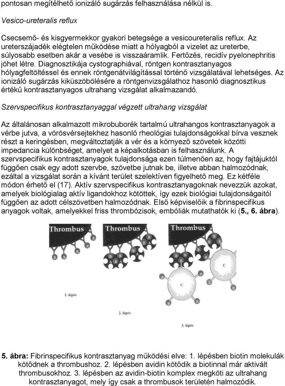 Diagnosztikája cystographiával, röntgen kontrasztanyagos hólyagfeltöltéssel és ennek röntgenátvilágítással történő vizsgálatával lehetséges.