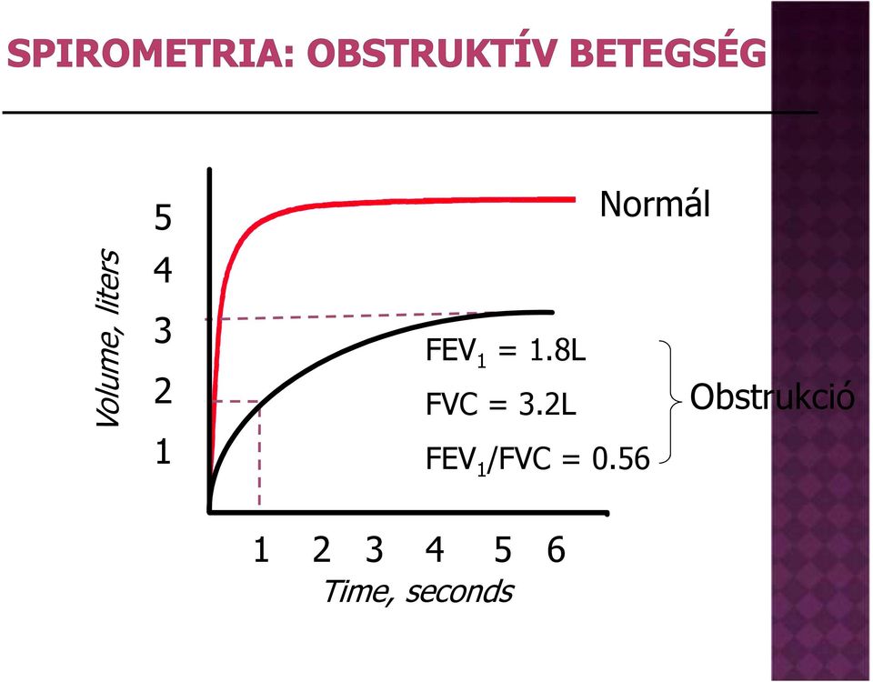 2L FEV 1 /FVC = 0.