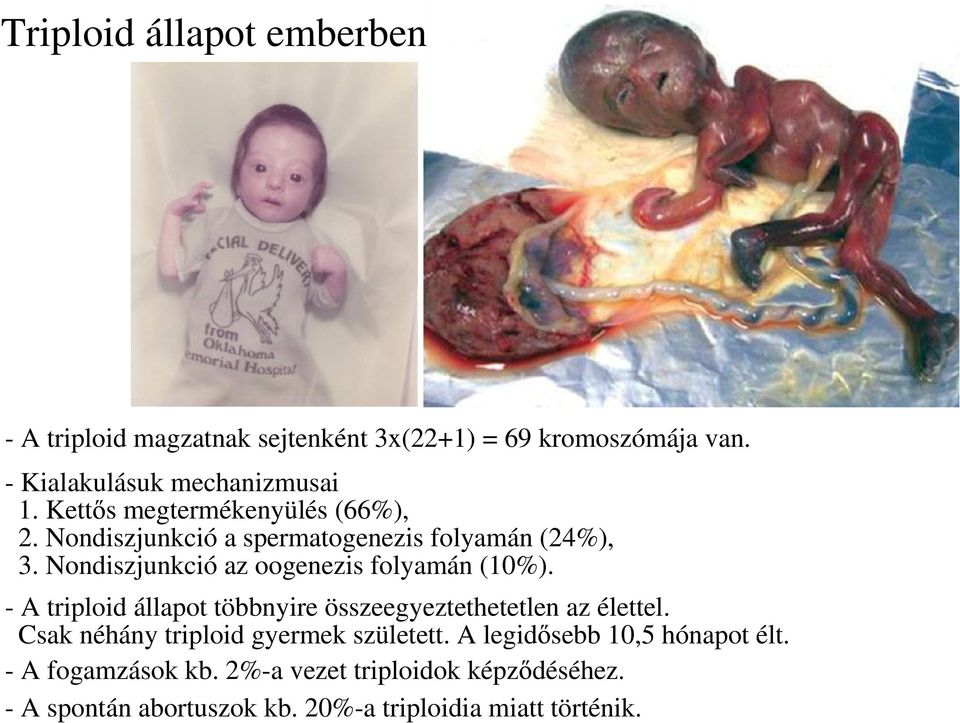 Nondiszjunkció az oogenezis folyamán (10%). - A triploid állapot többnyire összeegyeztethetetlen az élettel.