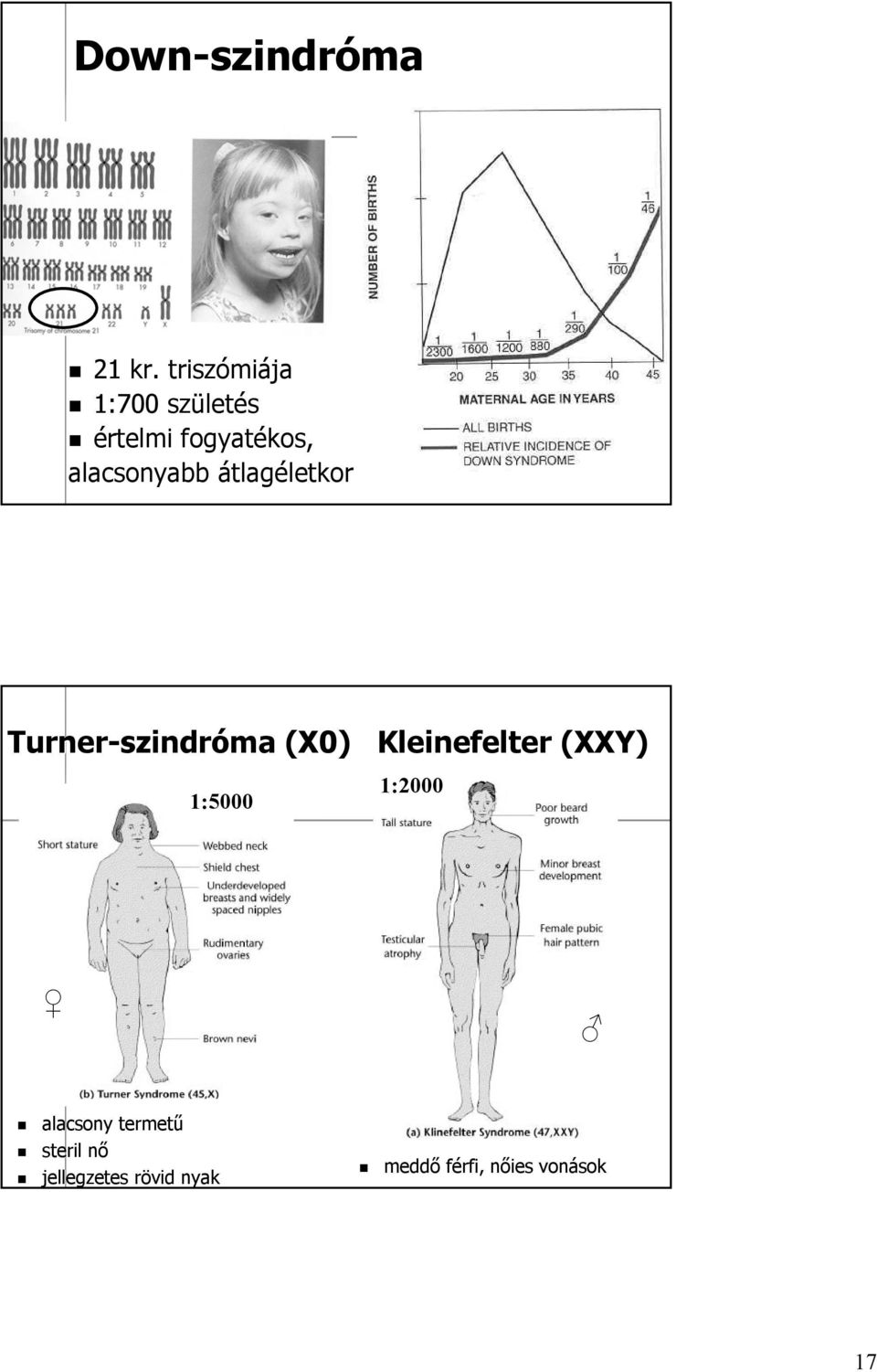 alacsonyabb átlagéletkor Turner-szindróma (X0)