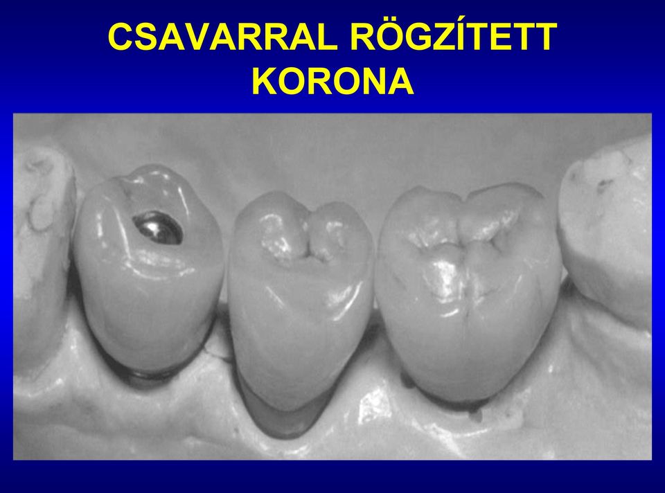 KORONA