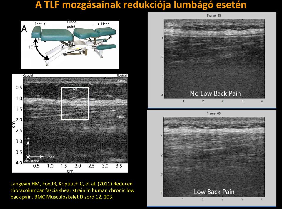 (2011) Reduced thoracolumbar fascia shear strain