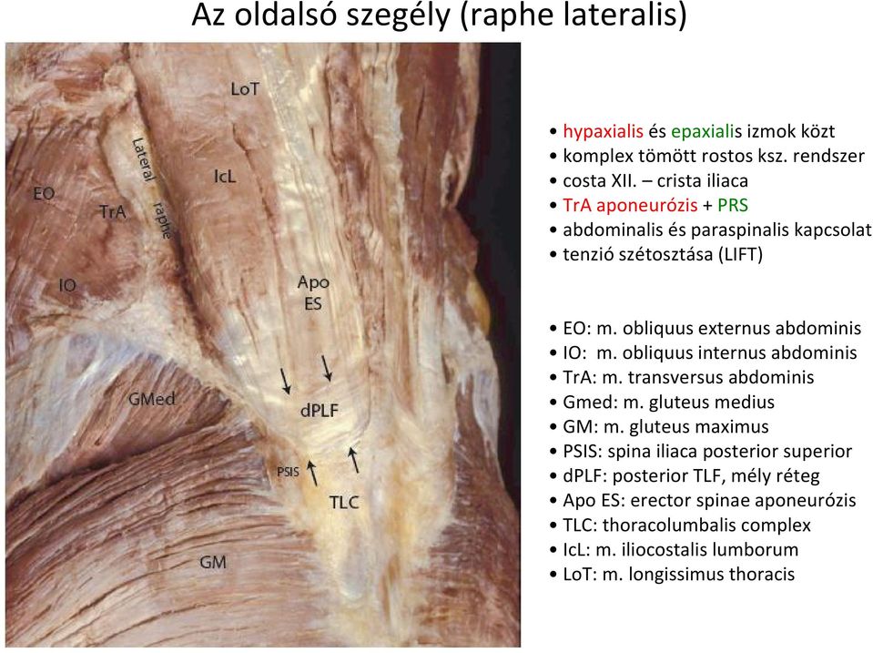 obliquus externus abdominis IO: m. obliquus internus abdominis TrA: m. transversus abdominis Gmed: m. gluteus medius GM: m.