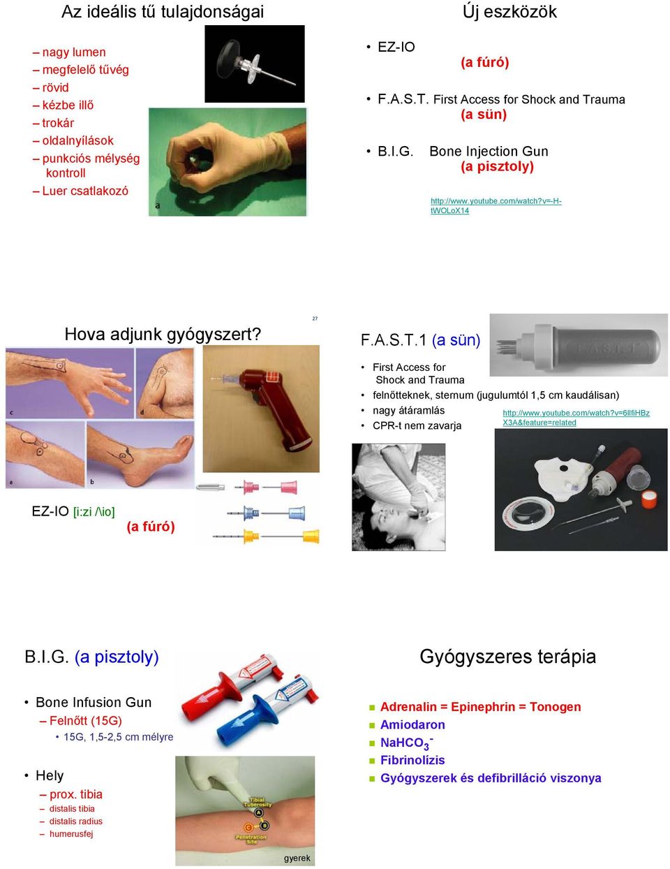 youtube.com/watch?v=6llfihbz X3A&feature=related EZ-IO [i:zi /\io] (a fúró) B.I.G. (a pisztoly) Gyógyszeres terápia Bone Infusion Gun Felnőtt (15G) 15G, 1,5-2,5 cm mélyre Hely prox.