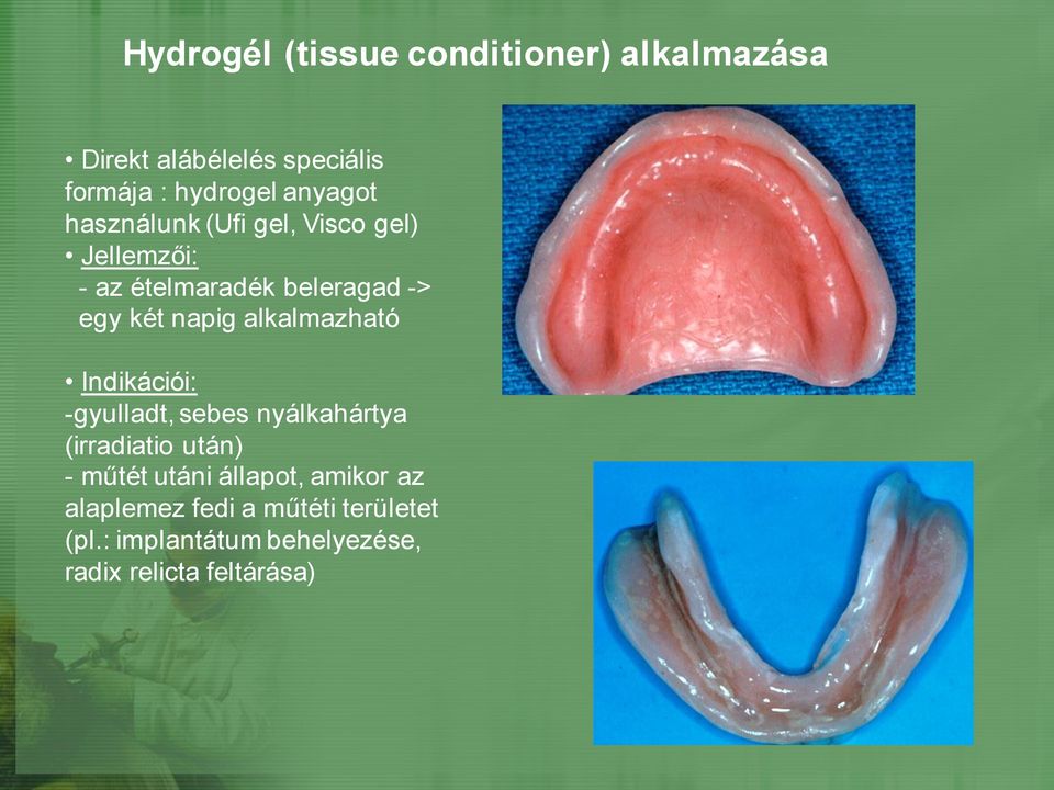 alkalmazható Indikációi: -gyulladt, sebes nyálkahártya (irradiatio után) - műtét utáni