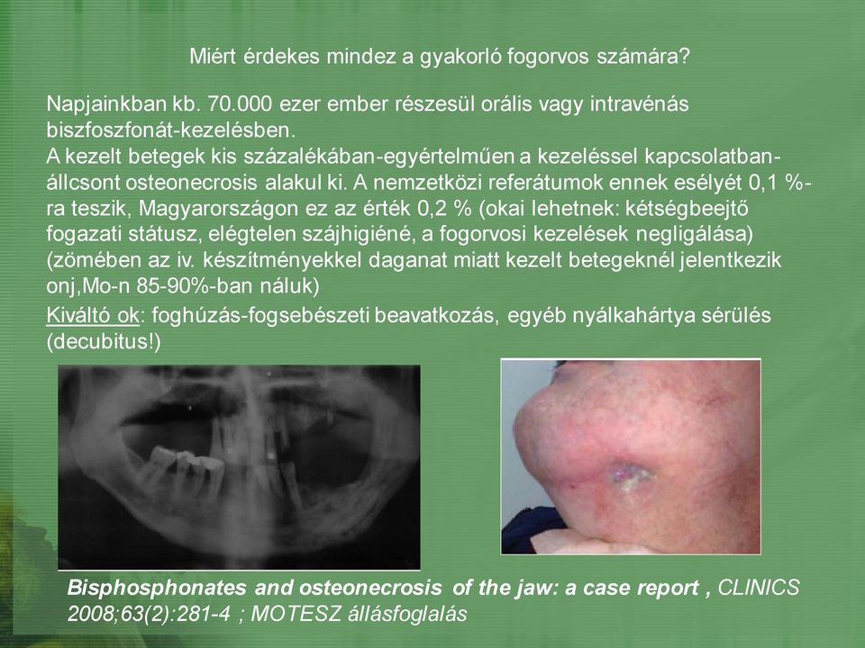 A nemzetközi referátumok ennek esélyét 0,1 %- ra teszik, Magyarországon ez az érték 0,2 % (okai lehetnek: kétségbeejtő fogazati státusz, elégtelen szájhigiéné, a fogorvosi kezelések