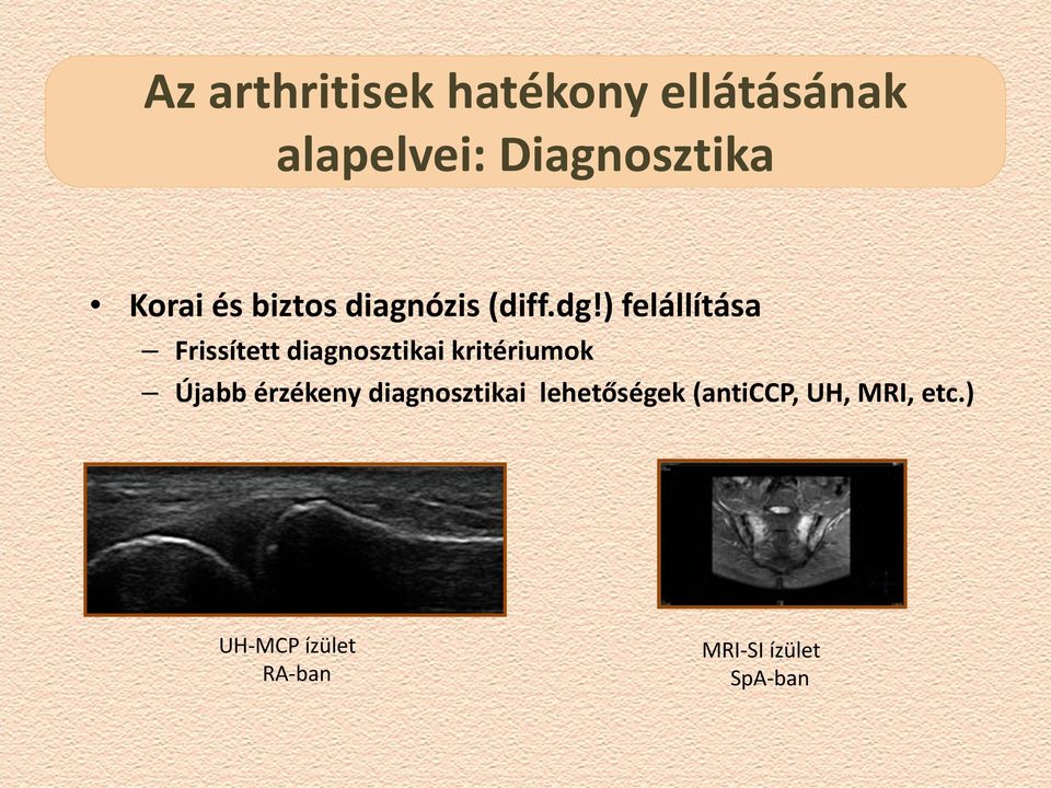 ) felállítása Frissített diagnosztikai kritériumok Újabb