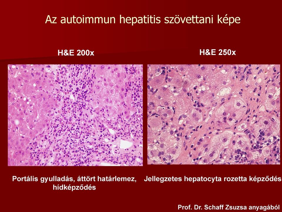 határlemez, hídképződés Jellegzetes