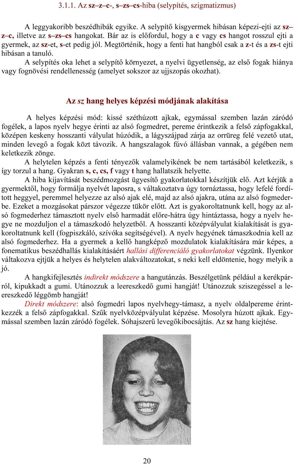 A selypítés oka lehet a selypítő környezet, a nyelvi ügyetlenség, az első fogak hiánya vagy fognövési rendellenesség (amelyet sokszor az ujjszopás okozhat).