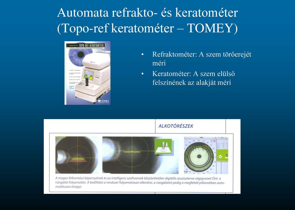 Refraktométer: A szem törőerejét méri