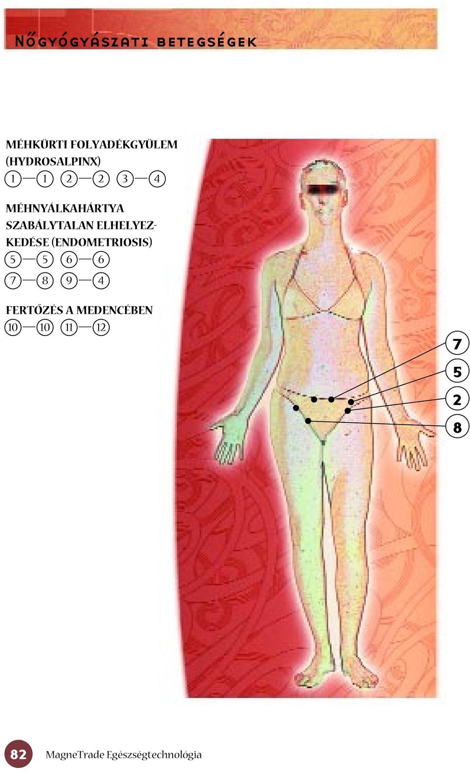 SZABÁLYTALAN ELHELYEZ- KEDÉSE (ENDOMETRIOSIS)