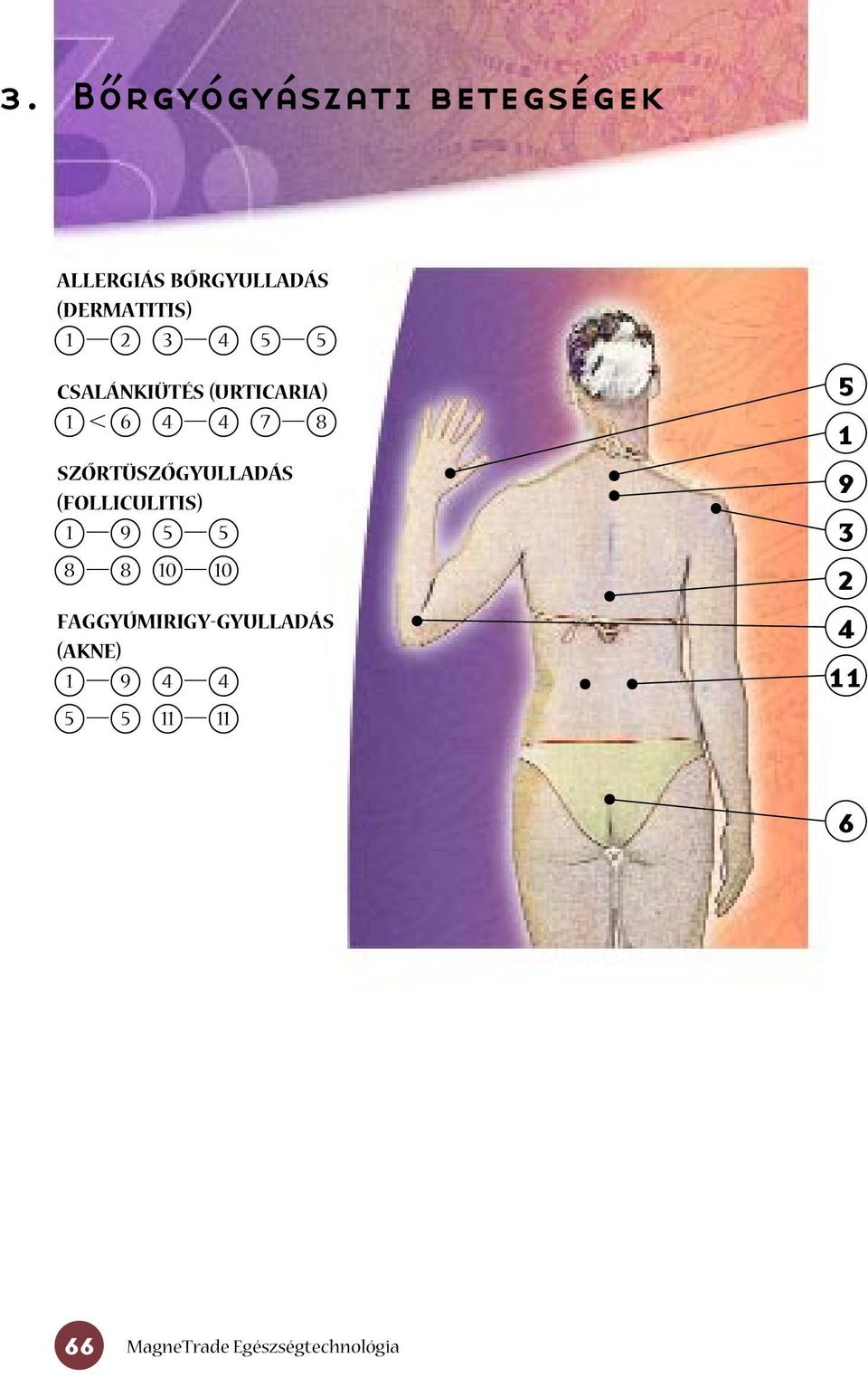 (URTICARIA) SZÔRTÜSZÔGYULLADÁS (FOLLICULITIS)