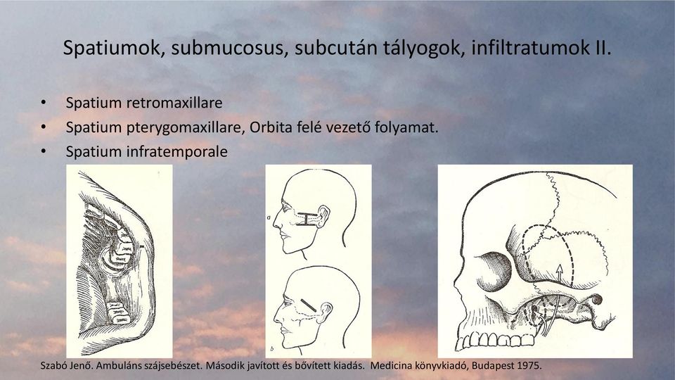 vezető folyamat. Spatium infratemporale Szabó Jenő.