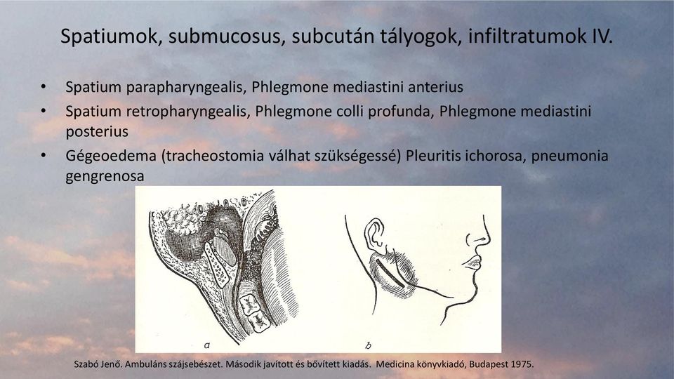 profunda, Phlegmone mediastini posterius Gégeoedema (tracheostomia válhat szükségessé) Pleuritis