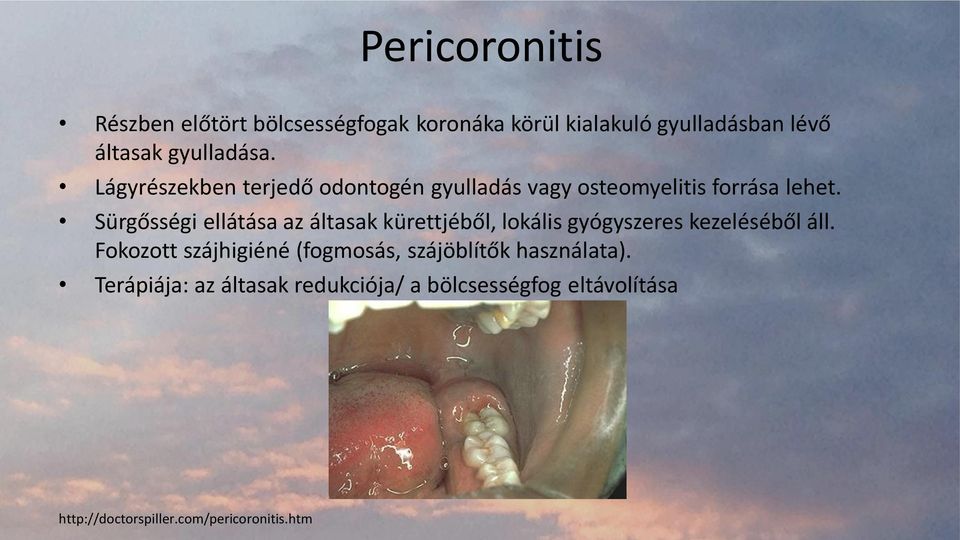 Sürgősségi ellátása az áltasak kürettjéből, lokális gyógyszeres kezeléséből áll.