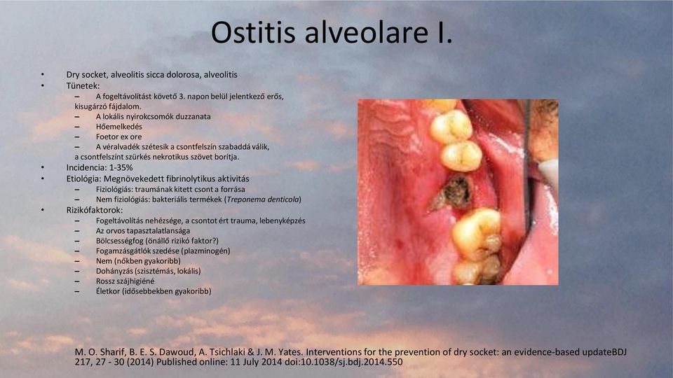 Incidencia: 1-35% Etiológia: Megnövekedett fibrinolytikus aktivitás Fiziológiás: traumának kitett csont a forrása Nem fiziológiás: bakteriális termékek (Treponema denticola) Rizikófaktorok: