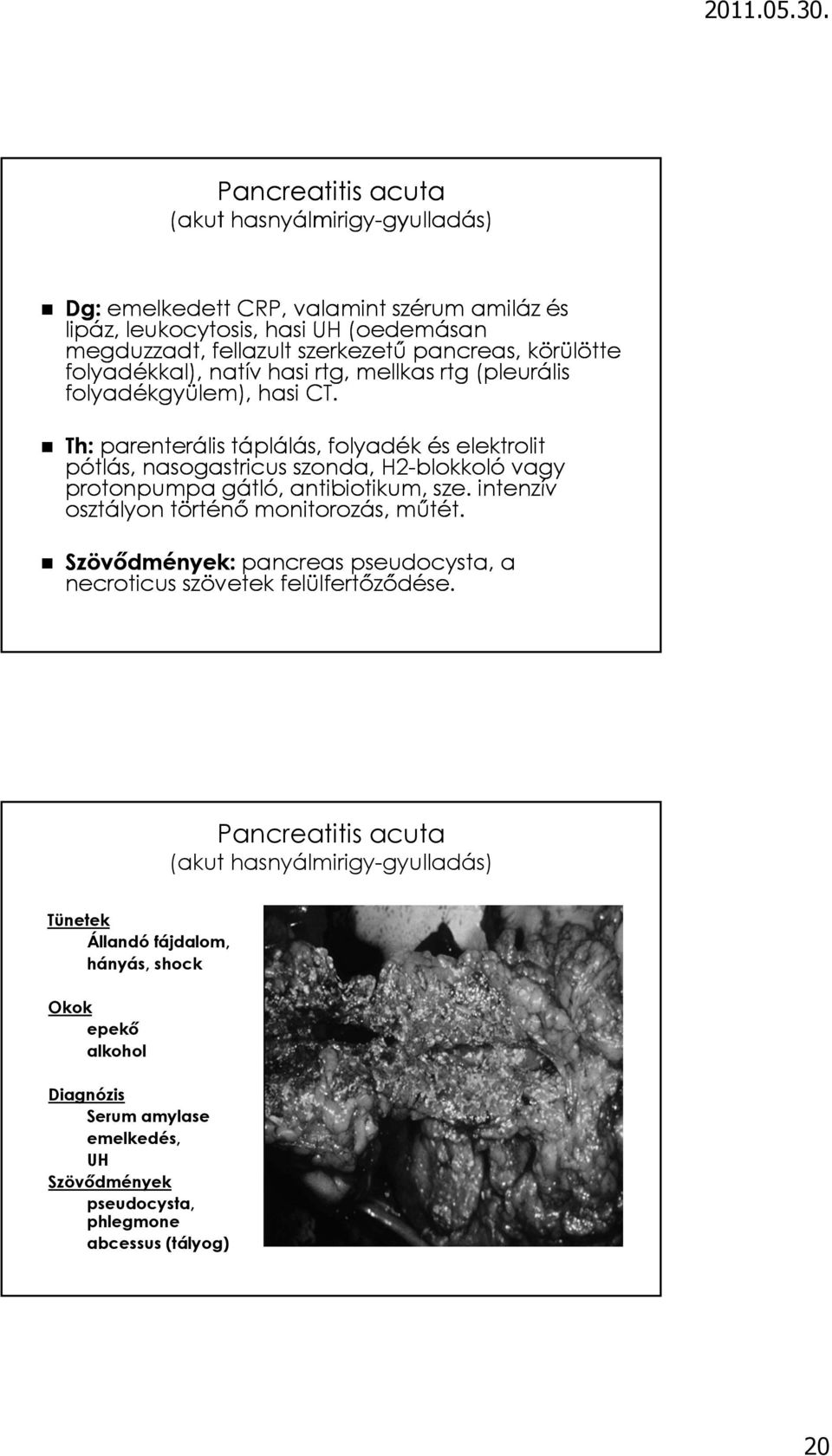 Th: parenterális táplálás, folyadék és elektrolit pótlás, nasogastricus szonda, H2-blokkoló vagy protonpumpa gátló, antibiotikum, sze. intenzív osztályon történő monitorozás, műtét.